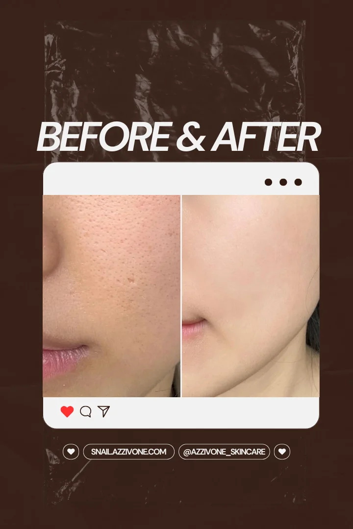 Transformation 1