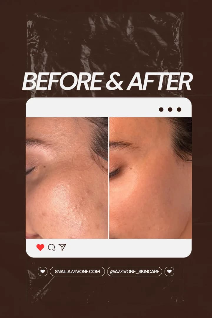 Transformation 3