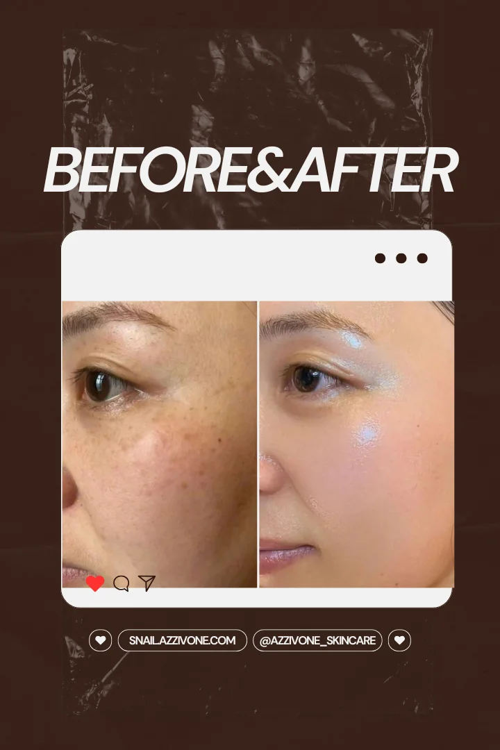 Transformation 5
