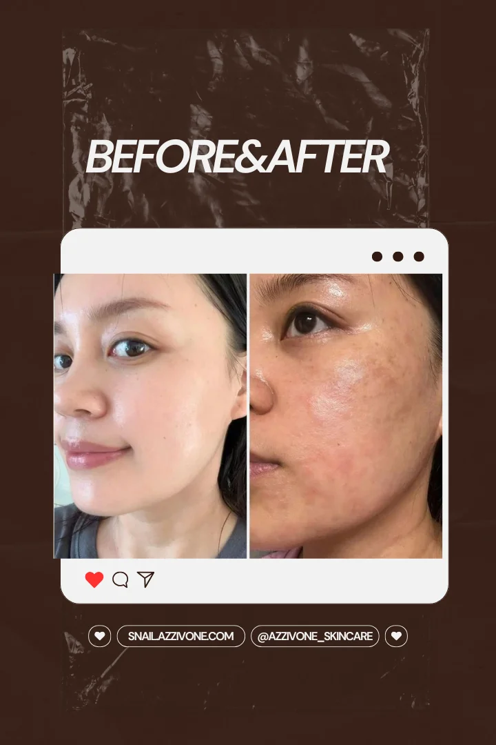 Transformation 6