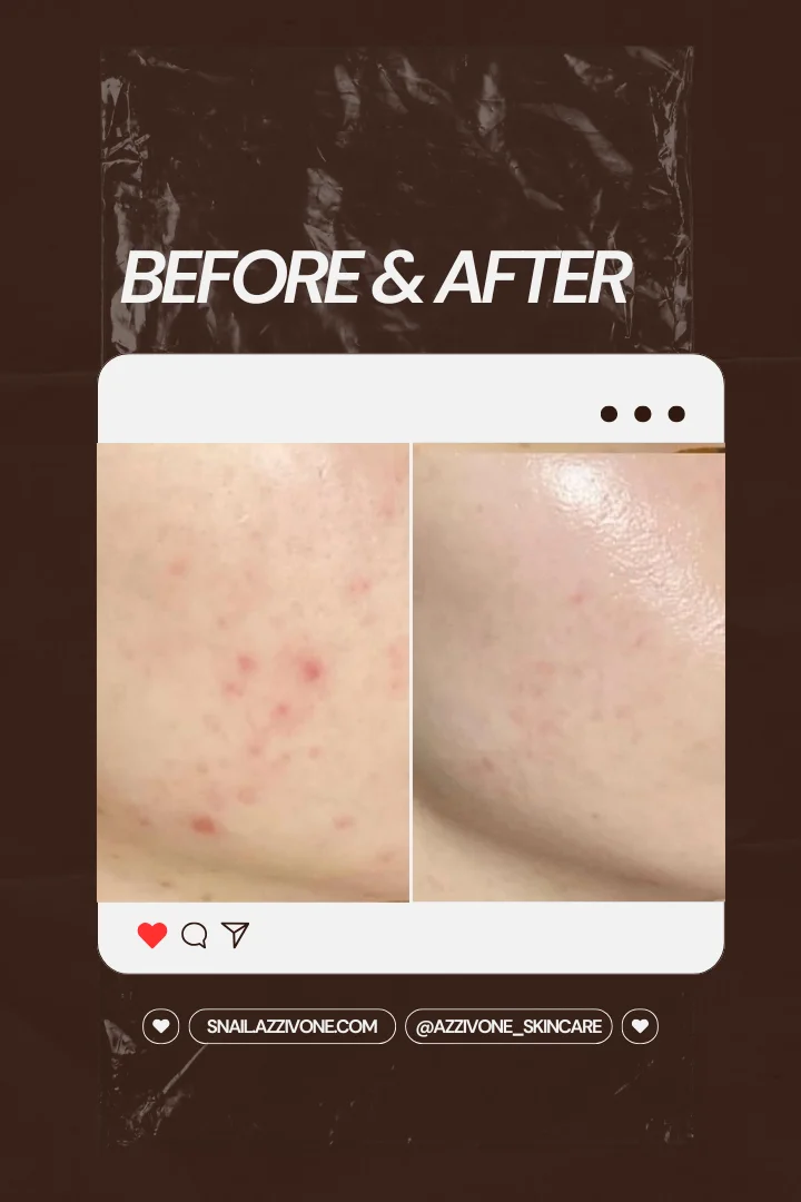 Transformation 8